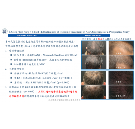 外泌體治療雄性禿有效嗎？前瞻性研究數據、風險與對象完整解析